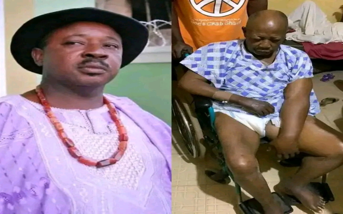 Actor Amaechi Muonagor cries for help over health condition