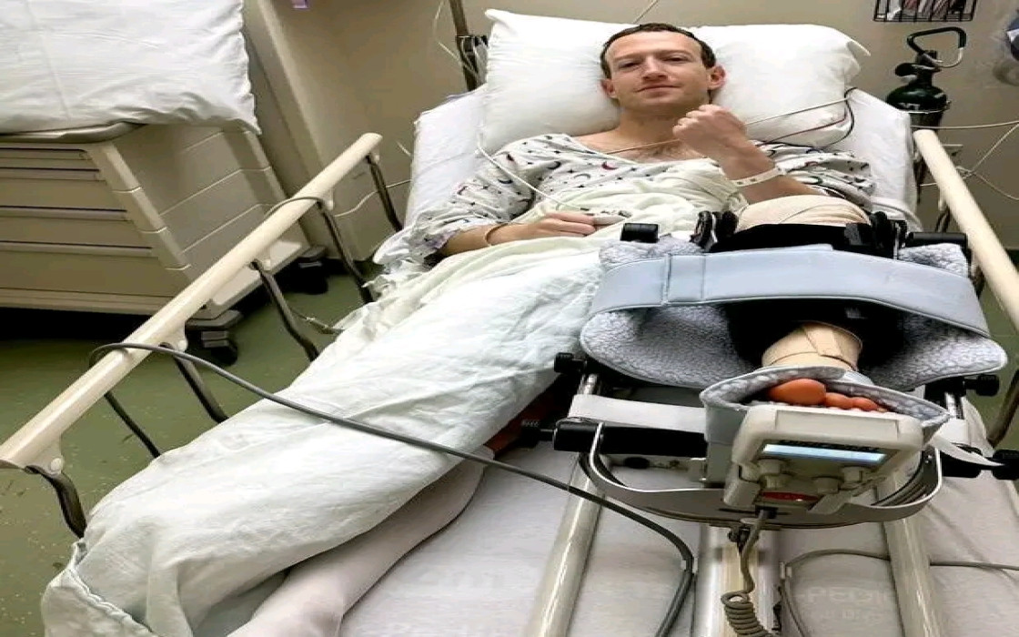 Mark Zuckerberg Undergoes Knee Surgery